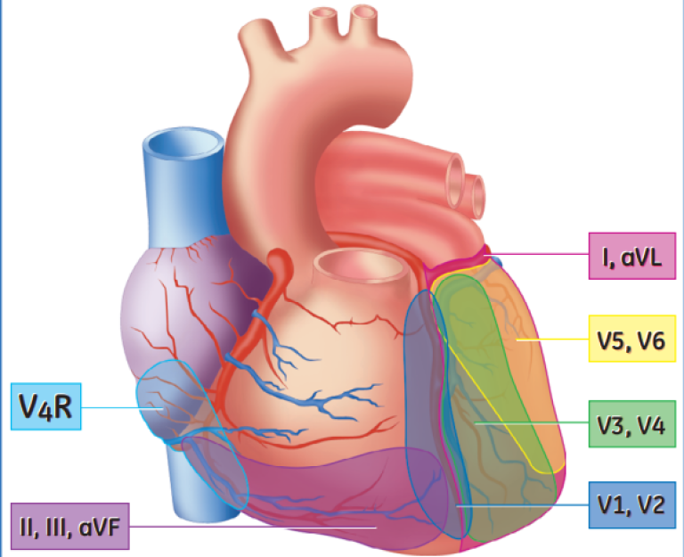 right-ventricular-involvement-ecg-clinical-view